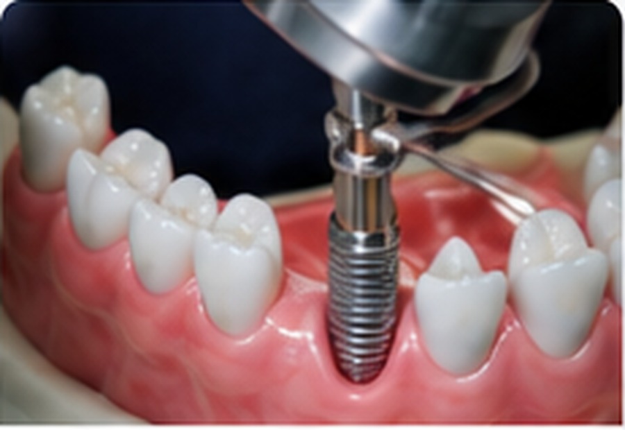 Relevant medical photo for this treatment